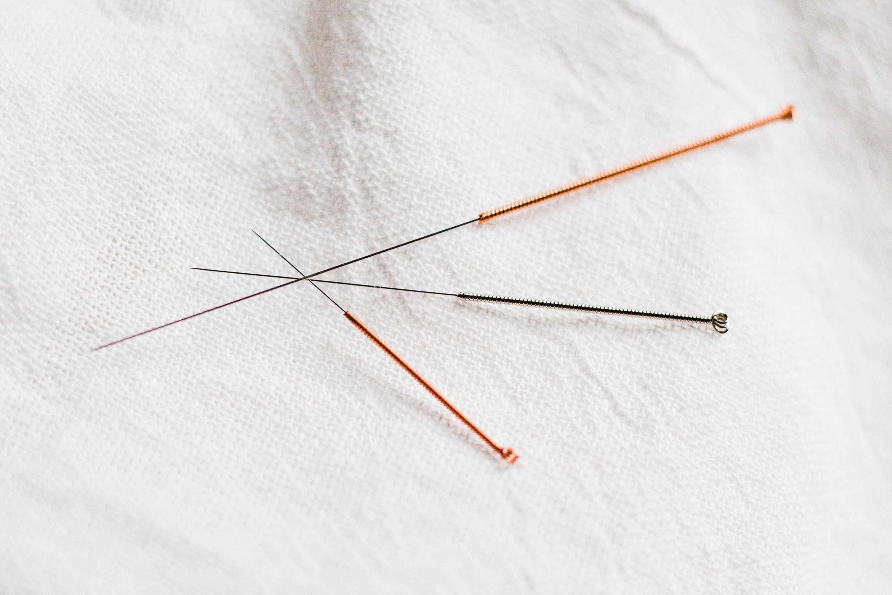 Acupuncture treatment can relieve any sorts of pain. Call us on 0288720477.